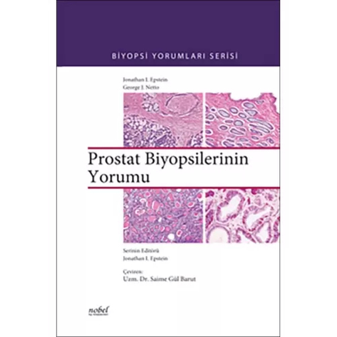 Prostat Biyopsilerinin Yorumu - Biyopsi Yorumları Serisi