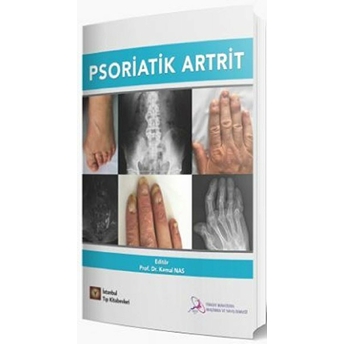 Psoriatik Artrit Kemal Nas