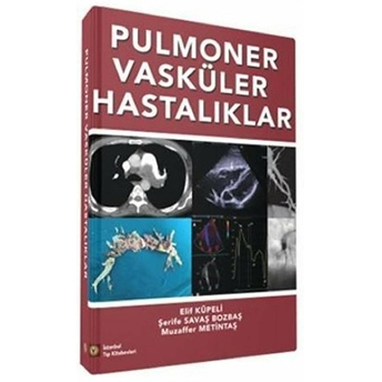 Pulmoner Vasküler Hastalıklar - Muzaffer Metintaş