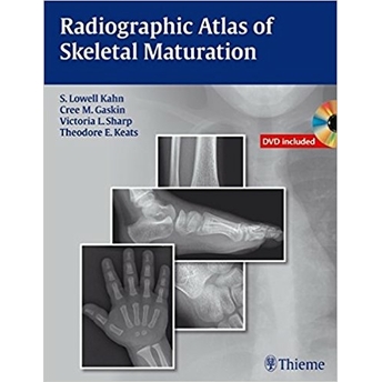 Radiographic Atlas Of Skeletal Maturation S. Lowell Kahn