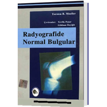 Radyografide Normal Bulgular Tevfik Pınar