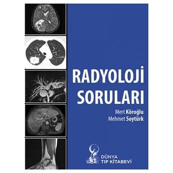 Radyoloji Soruları Mert Köroğlu