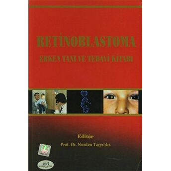 Retinoblastoma Erken Tanı Ve Tedavi Kitabı Nurdan Taçyıldız