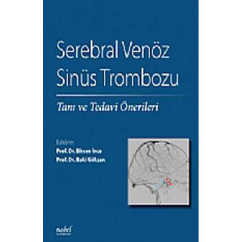 Serebral Venöz Sinüs Trombozu