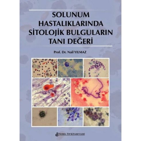 Solunum Hastalıklarında Sitolojik Bulguların Tanı Değeri