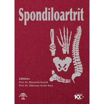 Spondiloartrit Kolektif