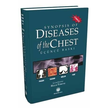 Synopsis Of Diseases Of The Chest (Türkçesi) Richard S. Fraser