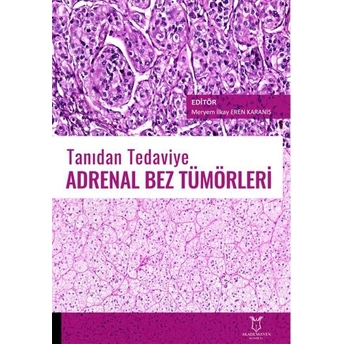 Tanıdan Tedaviye Adrenal Bez Tümörleri Meryem Ilkay Eren Karanis