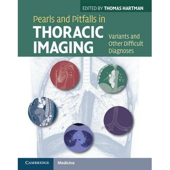 Thoracic Imaging Thomas Hartman