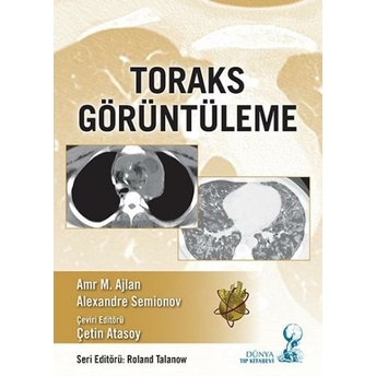 Toraks Görüntüleme Amr M. Ajlan