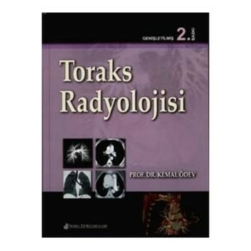 Toraks Radyolojisi