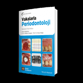 Vakalarla Periodontoloji Melike Camgöz