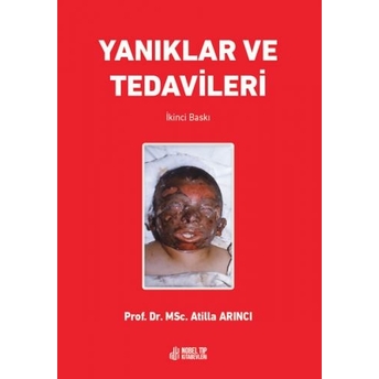 Yanıklar Ve Tedavileri Atilla Arıncı