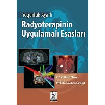 Yoğunluk Ayarlı Radyoterapinin Uygulamalı Esasları Gökhan Özyiğit